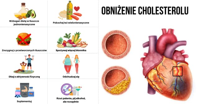 Czy cholesterol powoduje nadciśnienie? Odkryj niebezpieczne powiązania