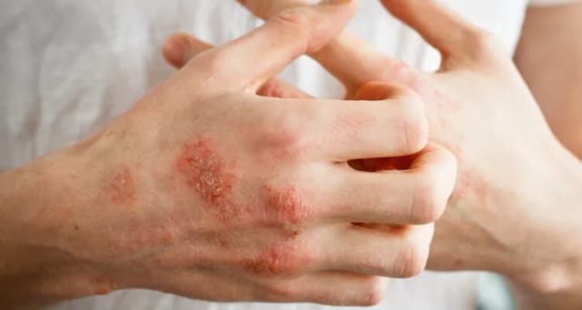 Jak sprawdzić uczulenie na gluten i uniknąć nieprzyjemnych objawów